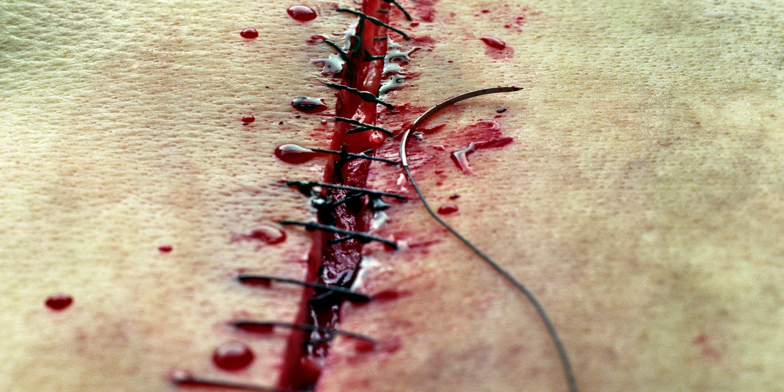 Kampanjbild Stitching